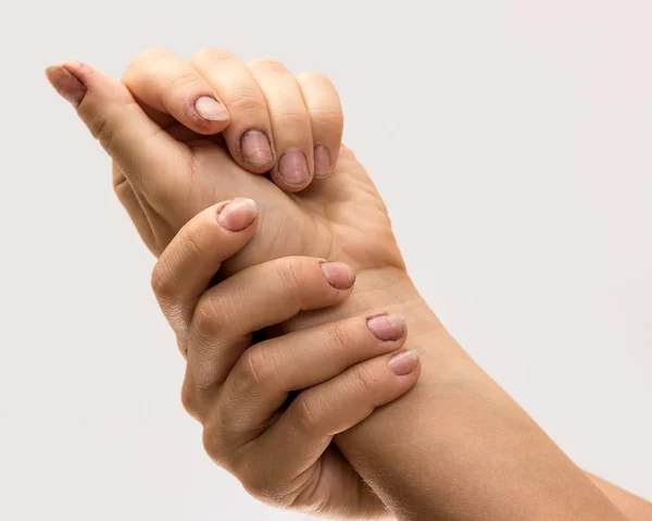 Mãos femininas com unhas sujas — Fotografia de Stock