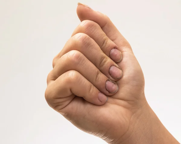 Mãos femininas com unhas sujas — Fotografia de Stock