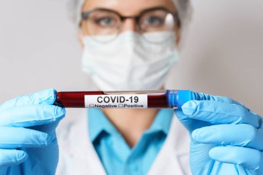 Genç bayan doktor COVID-19 'un kan örneğini tutuyor.