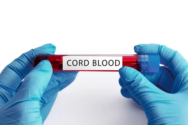 Close Scientist Hand Cord Blood Ampoule White Background — Stock Photo, Image