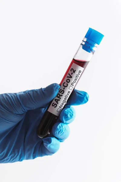 Close Scientist Hand Blood Sample Sars Cov — Stock Photo, Image