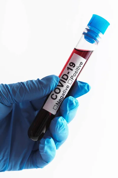 Close Scientist Hand Blood Sample Covid — Stock Photo, Image