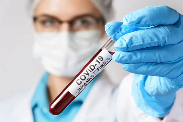 Ung Kvinnlig Läkare Håller Ett Blodprov Från Covid — Stockfoto