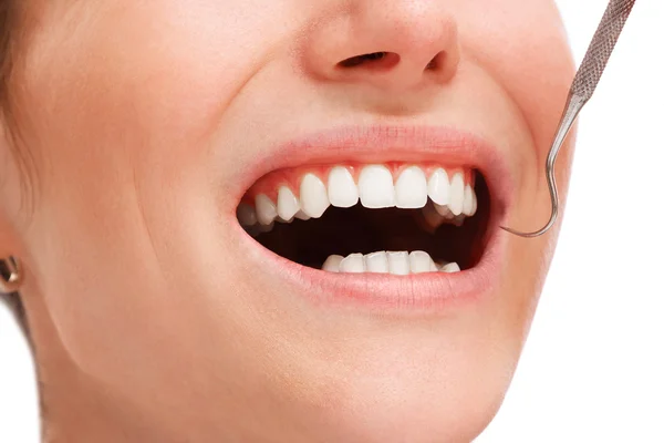 Female mouth with white teeth — Stock Photo, Image