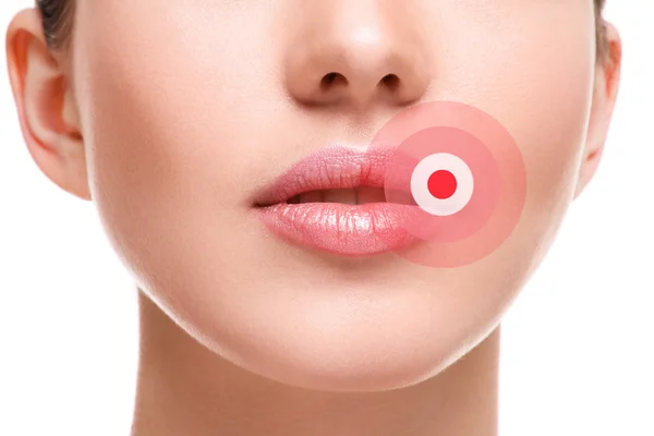 Female lips affected by herpes virus Stock Photo