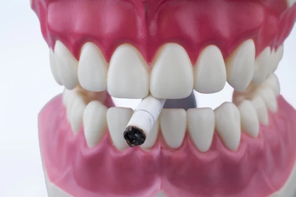 Teeth and cigarette — Stock Photo, Image