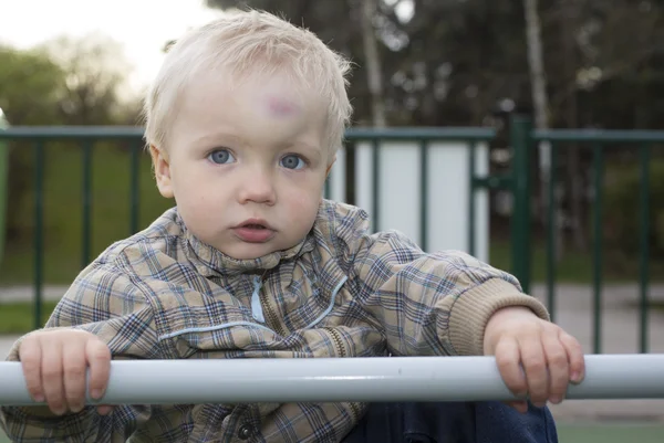 Niño con un golpe en la cabeza —  Fotos de Stock