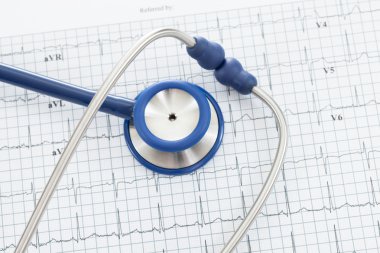 Stetoskop ekg cardiograms grafik - atış studio ile