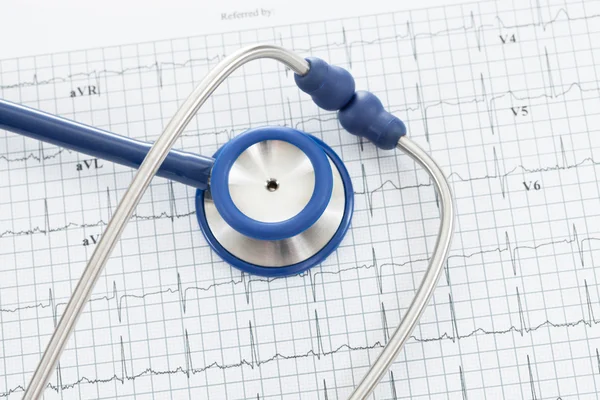 Stetoscopio con grafico di ekg elettrocardiogramma - colpo dello studio — Foto Stock