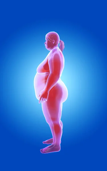 Fat and thin woman. x-ray view Stock Image