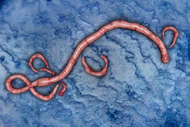 Ebola virüsü