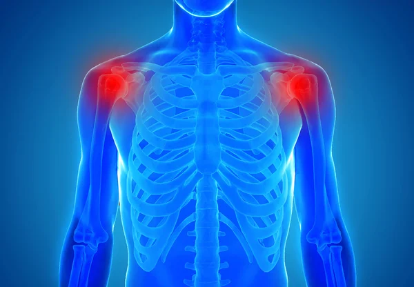 Anatomy of human shoulder joints - injury concept — Stock Photo, Image