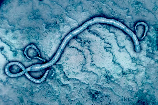 Wirus Ebola — Zdjęcie stockowe