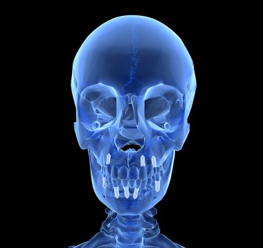 diş implantı ve diş