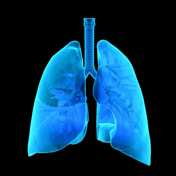 Radiografía de los pulmones humanos — Foto de Stock