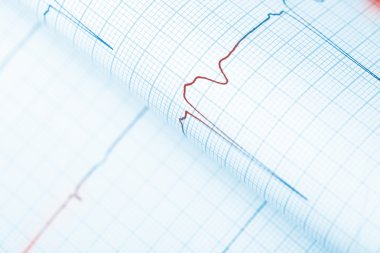 Kızgın çizgi grafiği tehlikesi uyardı