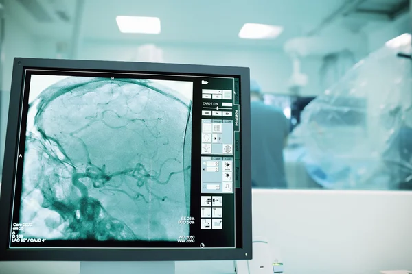 Ameliyat sırasında beyin damarlarının izleme — Stok fotoğraf