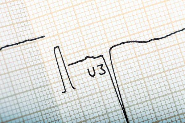 Gráfico de investigación con la curva —  Fotos de Stock