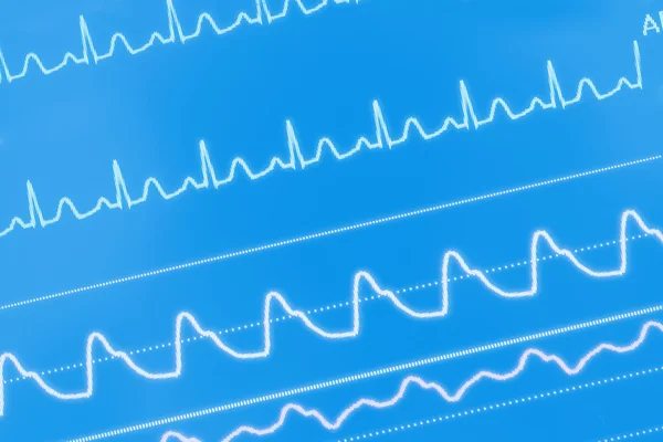 EKG dalgalar üstünde belgili tanımlık perde — Stok fotoğraf