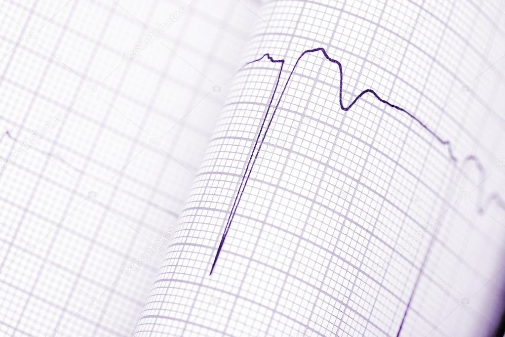 Folded graph paper with ECG