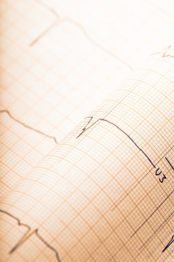 Retro EKG kağıt arka plan tarz