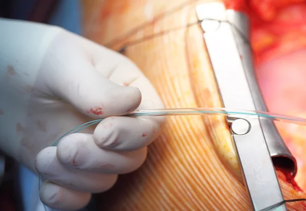 Daily surgeons work in the operating room — Stock Photo, Image