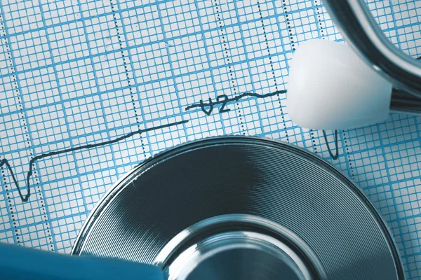 ECG e stetoscopio macro, concetto medico — Foto Stock