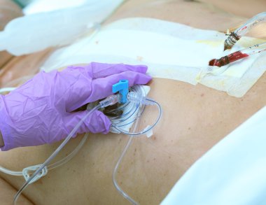 Erken Postoperatif dönemde gelişen hasta bakımı