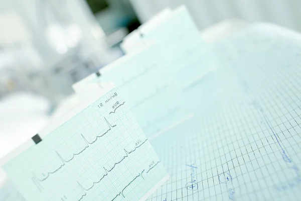 ECG e documenti medici sulla tabella medici — Foto Stock