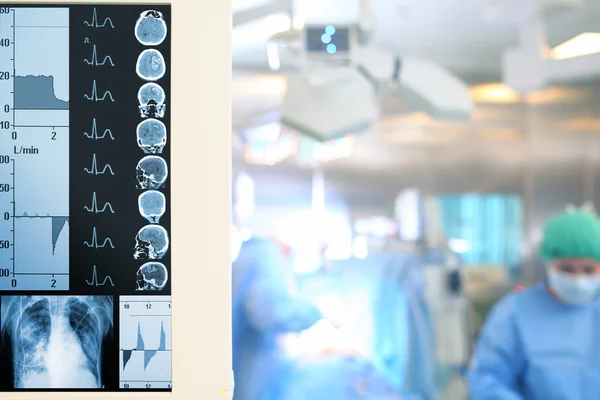 Современный мониторинг пациента во время операции — стоковое фото