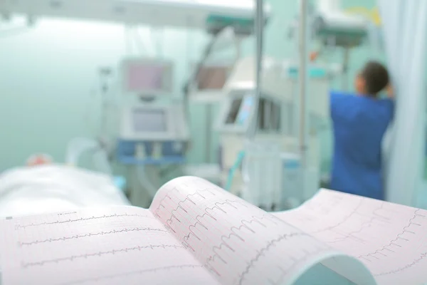 ECG at the background of medical staff working with the patient — Stock Photo, Image