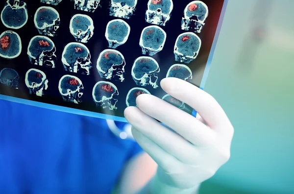 Arzt untersucht den MRI-Scan des Patienten genau Stockbild