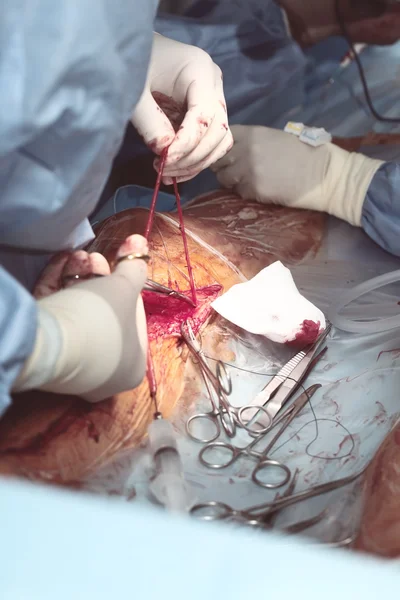 Рабочий процесс команды хирургов — стоковое фото