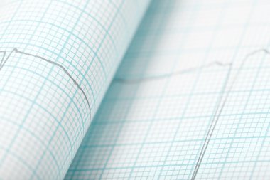 EKG kavramı dikkatli muayene