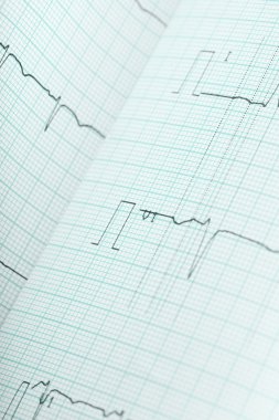 EKG tıbbi geçmişi