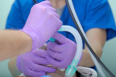 Endotrakeal tüp aracılığıyla pulmoner muayene