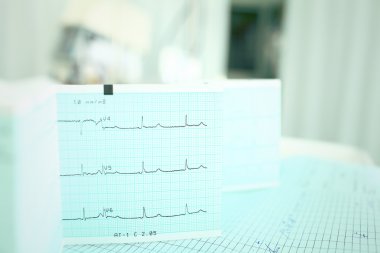 EKG doktorlar masada