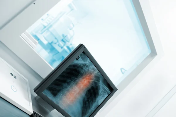 Computer in the x-ray cabinet — Stock Photo, Image