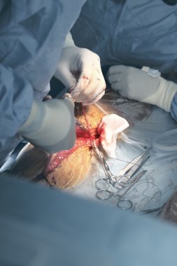 Ameliyathane cerrahi sırasında tıbbi işçi