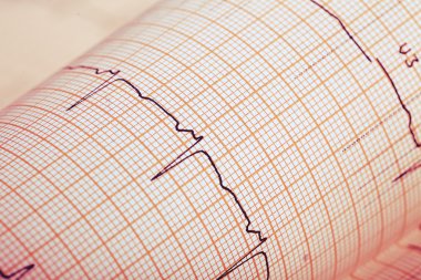 Kayıt EKG kağıt üzerinde