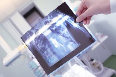 X-Ray hasta doktor elinde