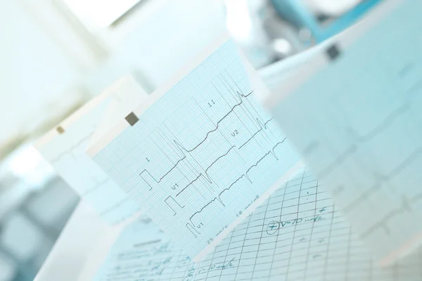 Gráfico de ECG na tabela de médicos — Fotografia de Stock