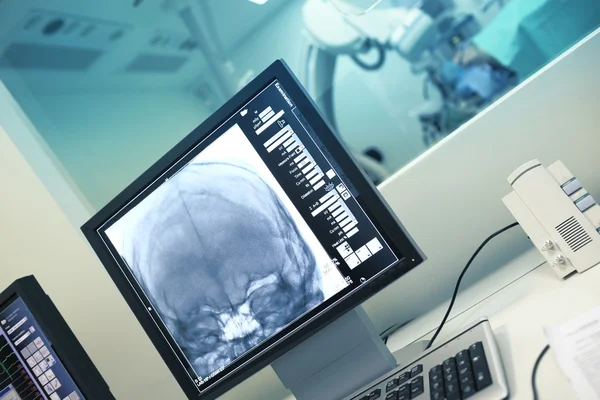 X-ray onderzoek van hoofd op de monitor — Stockfoto