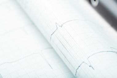 EKG kağıt doktorlar Office