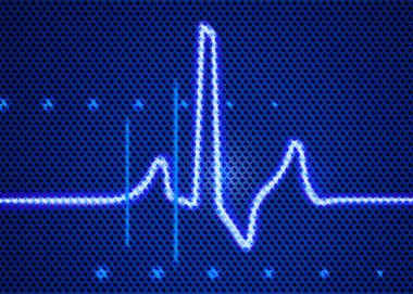 Cardiomonitor tıbbi teknoloji unsuru