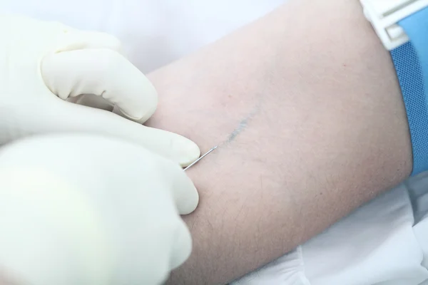 Operação médica: injeção intravenosa. Foto de close-up — Fotografia de Stock