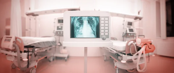 X-Ray monitor in panoramisch Icu ward — Stockfoto