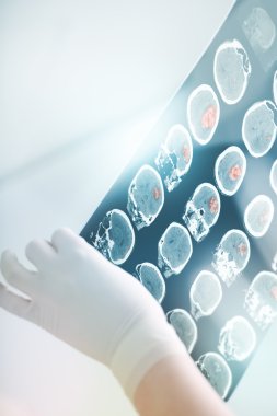 CT taraması tıbbi hastane parlak ışık