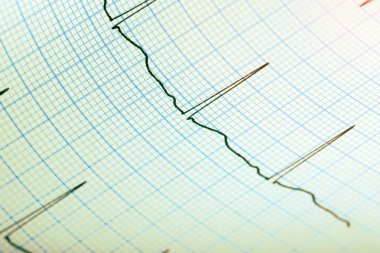 EKG kayıt kağıt tıbbi geçmişi