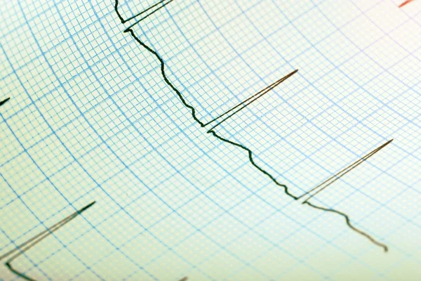 EKG rekord papper medicinsk bakgrund — Stockfoto